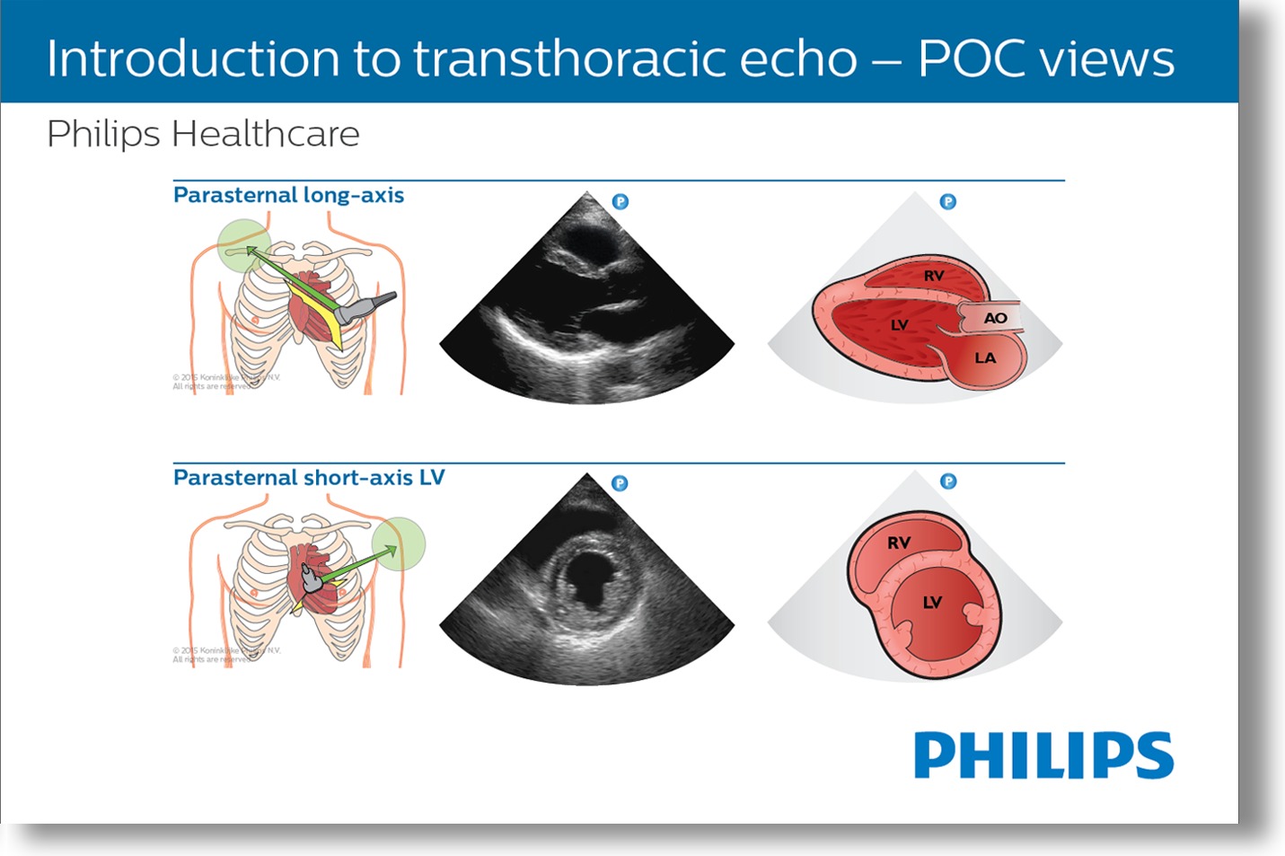 Emergency Medicine Tutorials Philips Ultrasound